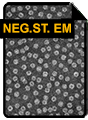 Microscopia EM a colorazione negativa