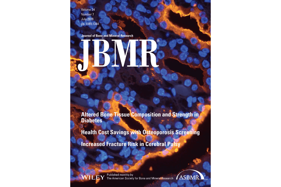 SiMPLOD, a structure-integrated database of collagen lysyl hydroxylase (LH/PLOD) enzyme variants