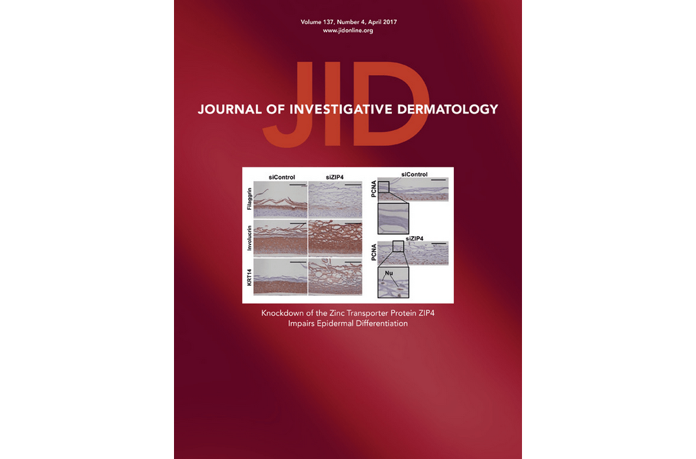 Autosomal recessive Keratoderma-Ichthyosis-Deafness (ARKID) syndrome is caused by VPS33B mutations affecting Rab protein interaction and collagen modification