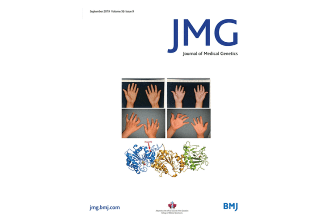 Pathogenic variants in PLOD3 result in a Stickler syndrome-like connective tissue disorder with vascular complications